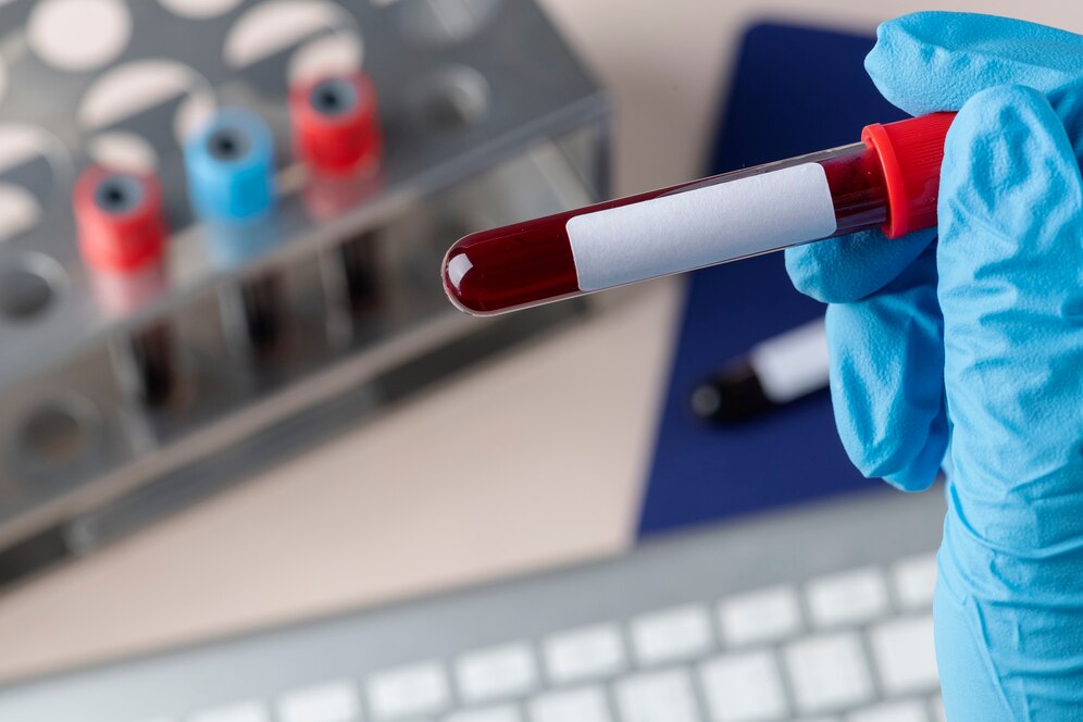 FBE blood test